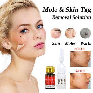 Removal Face Wart Tag Freckle Cream Removal Oil Mole Skin Tag Removal Solution Painless Mole Skin Dark Spot T
